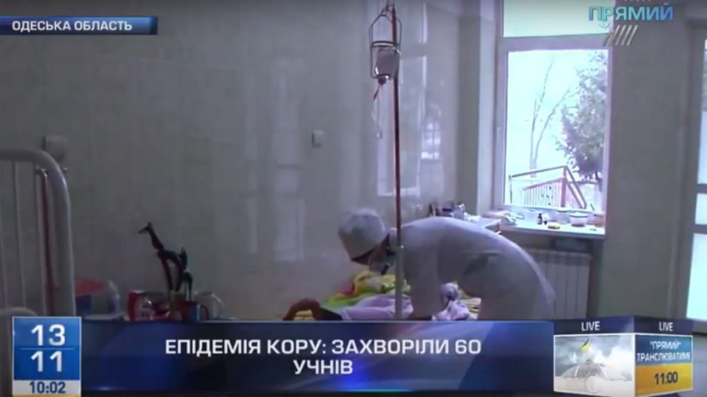 Спалах епідемії кору на Одещині: захворіло 20 дітей