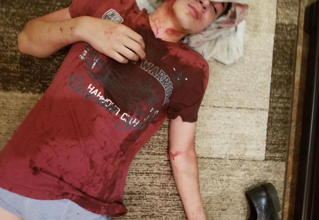 На Київщині затримали чоловіка, який розбив пляшку вина об голову сина та побив дружину