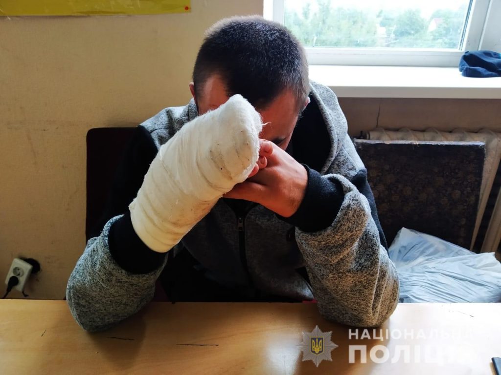 На Киевщине мужчина перерезал горло своей жене во время ссоры