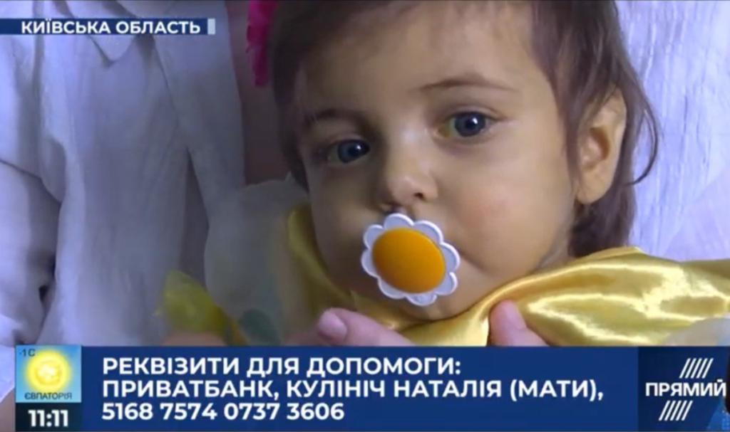 Маленькій Софійці Кулініч потрібна допомога: дівчинка народилася з рідкісною патологією
