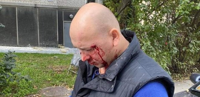 У центрі Києва жорстоко побили ветерана війни на Донбасі і його дружину