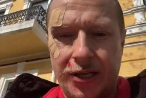 В Києві невідомий на самокаті побив журналіста Майкла Щура
