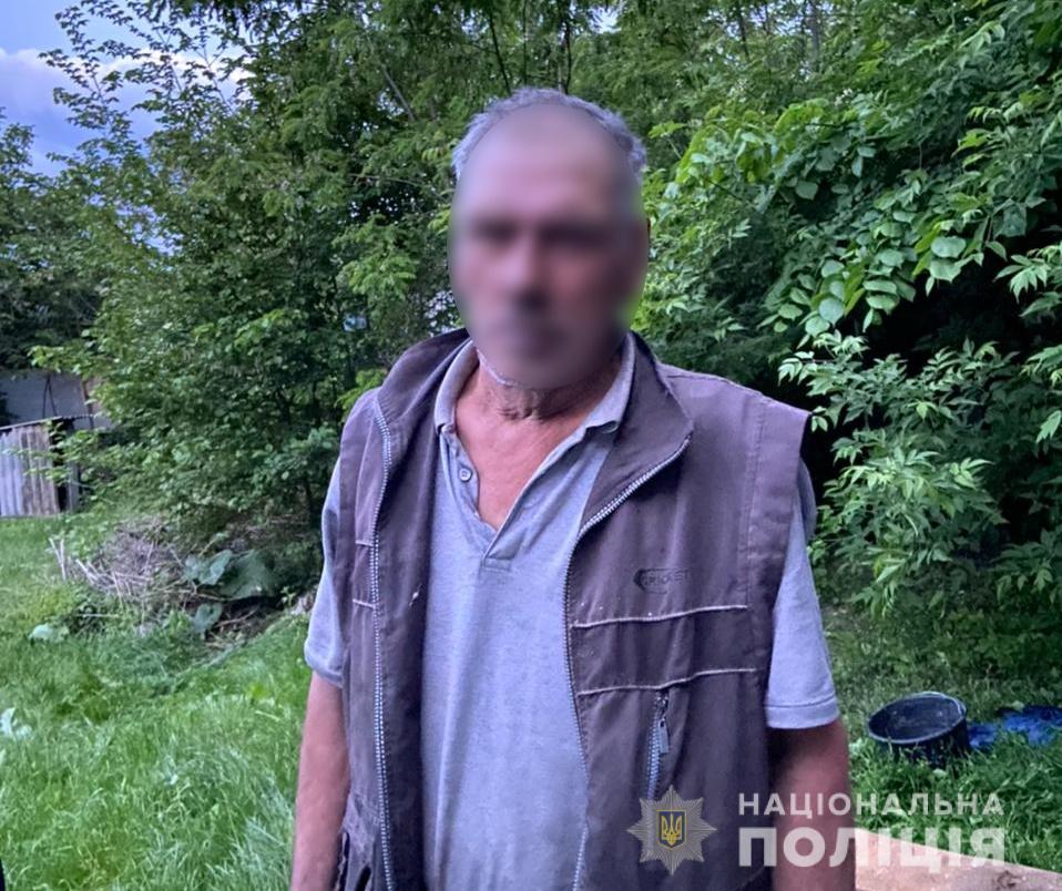На Київщині чоловік підпалив дружину: жінку госпіталізовано
