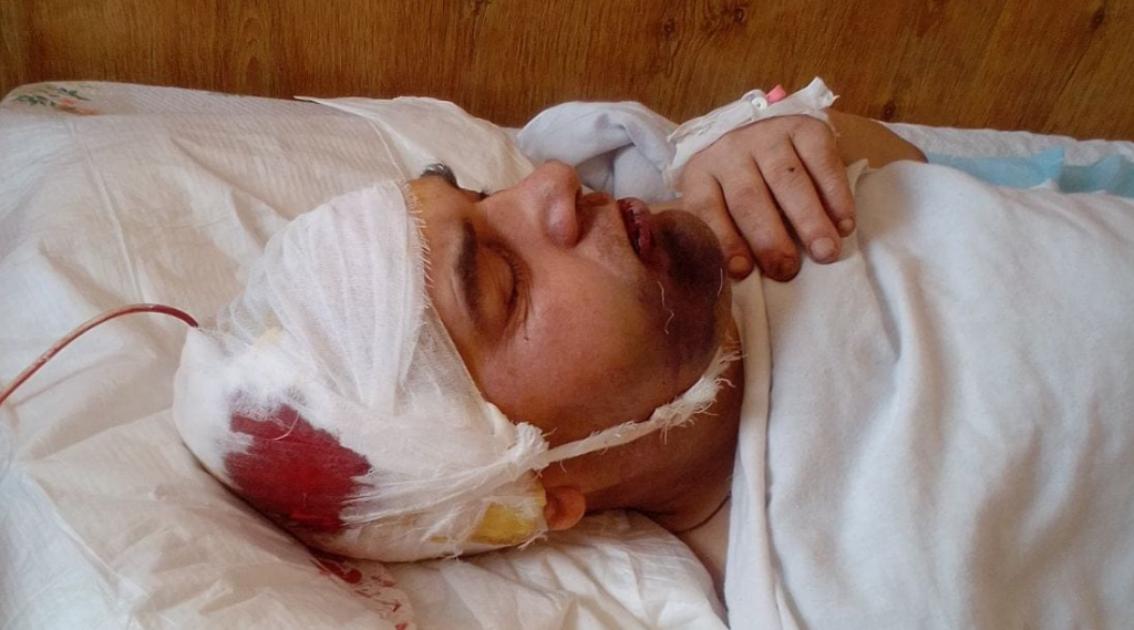 На Волині офіцер 14 ОМБр побив пораненого солдата й залишив його стікати кров’ю