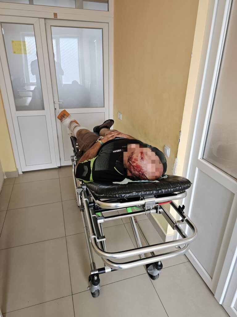 Намагався втекти з України: киянин зламав ногу, зістрибнувши з потяга