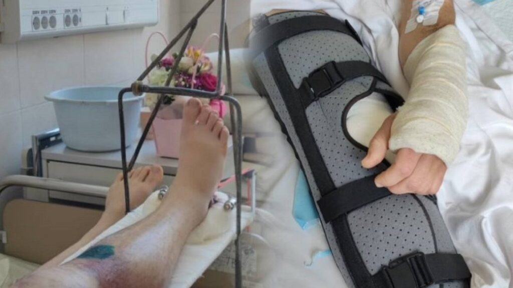 У Франківську чоловіку зламали руку й ногу та відвезли до ТЦК: омбудсман вимагає розслідування